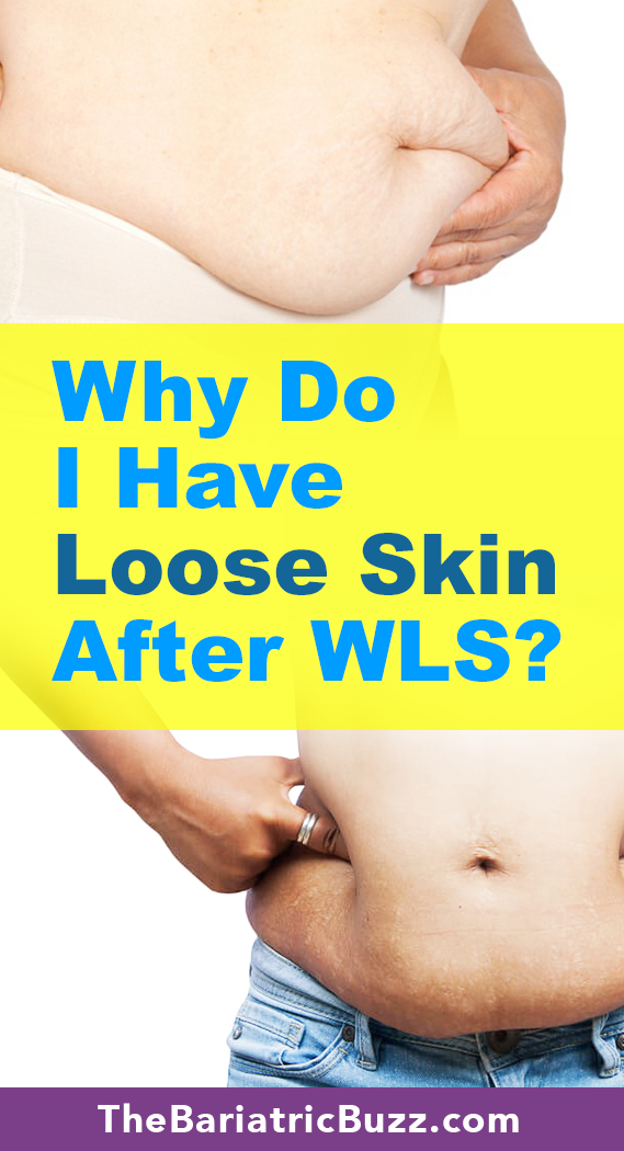 Loose Skin After WLS